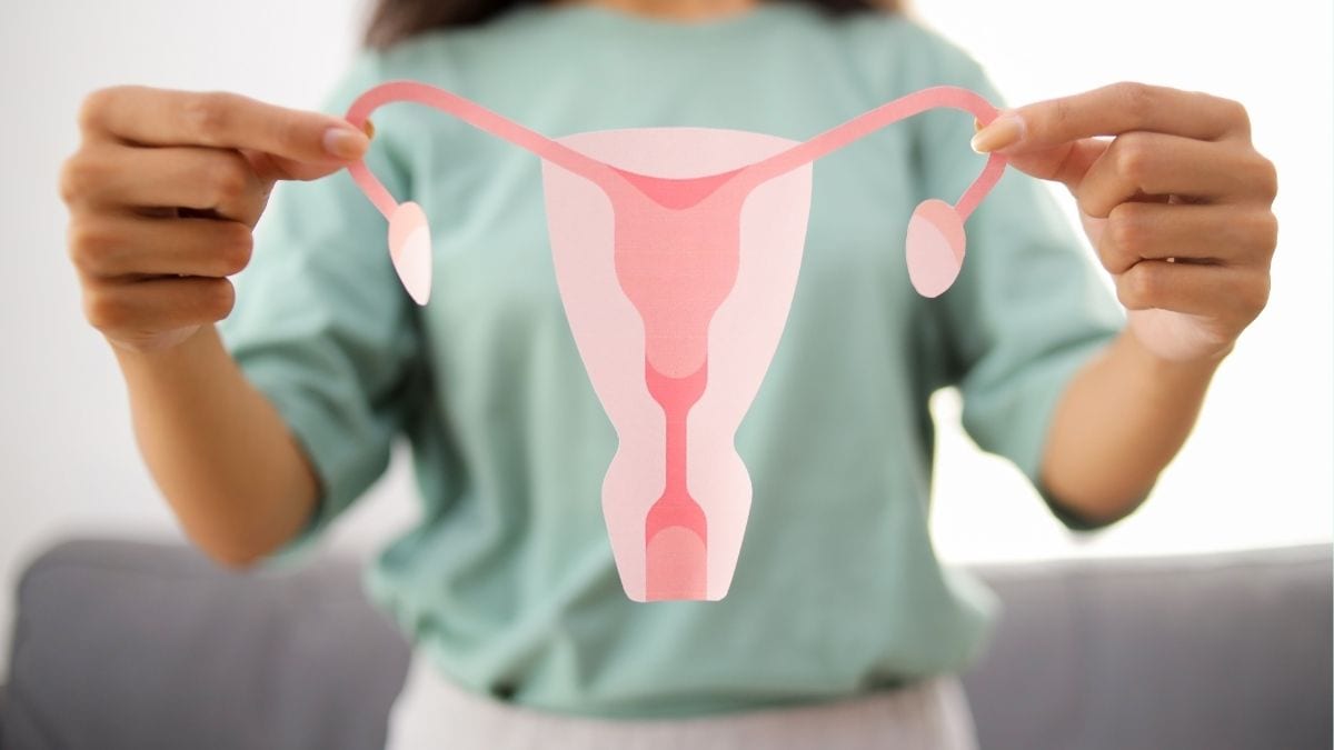 A New Name for PCOS? Experts Propose PMOS and Here’s What It Means