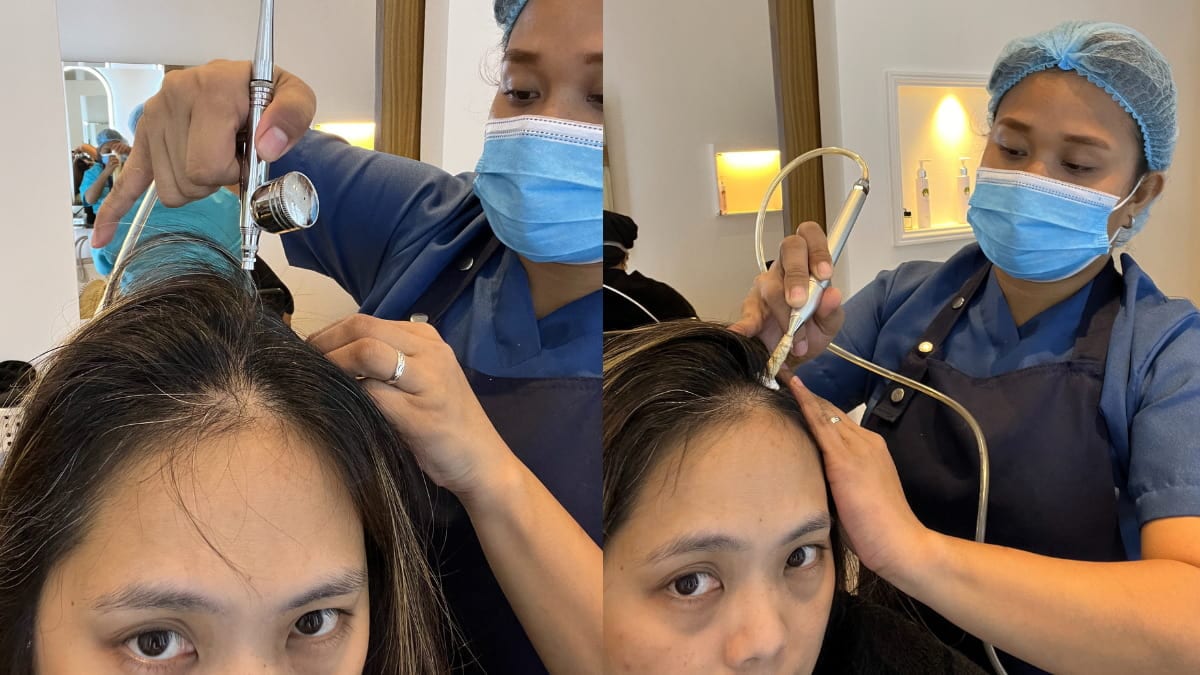 scalp treatment