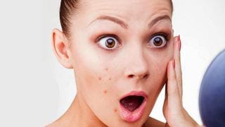 5 Everyday Things That Can Cause Skin Breakouts 