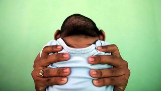 Two Babies Born with Microcephaly Reported in Iloilo