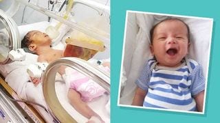 'My Baby Was Born With His Organs Sticking Outside of His Belly'