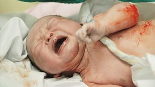 What you Need to Know about Coiled Umbilical Cords
