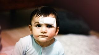 Mga Red Flags Kung Nahulog Mula sa Kama o Mataas na Lugar ang Iyong Anak
