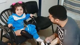 'I Am Beautiful': 3-Year-Old Amputee Gets A New Prosthetic Leg