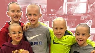 A Good Deed Indeed! Classmates Shave Their Heads to Support Their Friend With Alopecia
