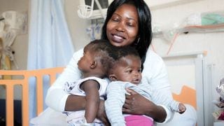 Successful Surgery Separates Twins Joined At Head At Vatican Pediatric Hospital
