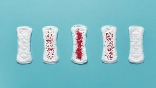 8 Posibleng Dahilan Ng Mahinang Menstruation Bukod Sa Pagbubuntis