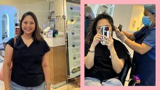 Mom Review: Scalp Treatments Might Solve Your Hair Fall Problems