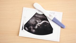 Pregnancy and Autism: Risks, Realities, and What You Can Do
