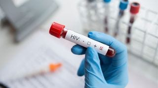 DOH Urges HIV Emergency as Cases Surge, Youth Most Affected
