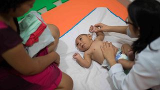 Top of the Morning: DOH Will Now Test Suspected Microcephaly Cases For Zika Virus